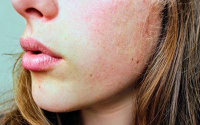 The Benefit of Vitamin E for Wrinkles and Dark Spots – And How You Can Use It